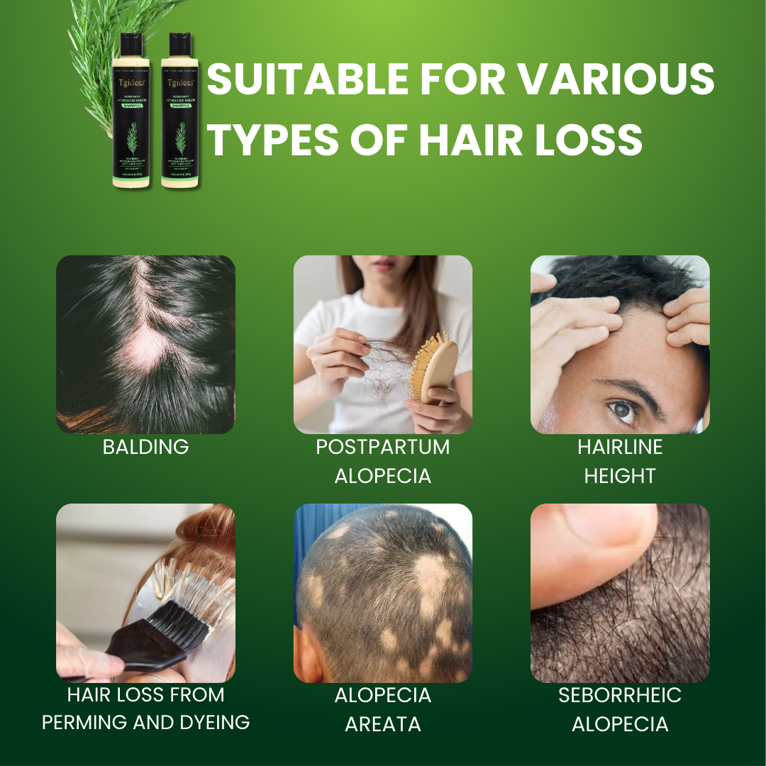 Tgideas® - Rosemary Hydrolyzed Keratin Shampoo
