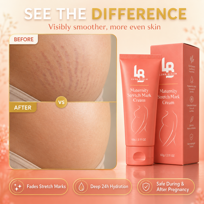 Luna Bloom™ — Stretch Mark Cream